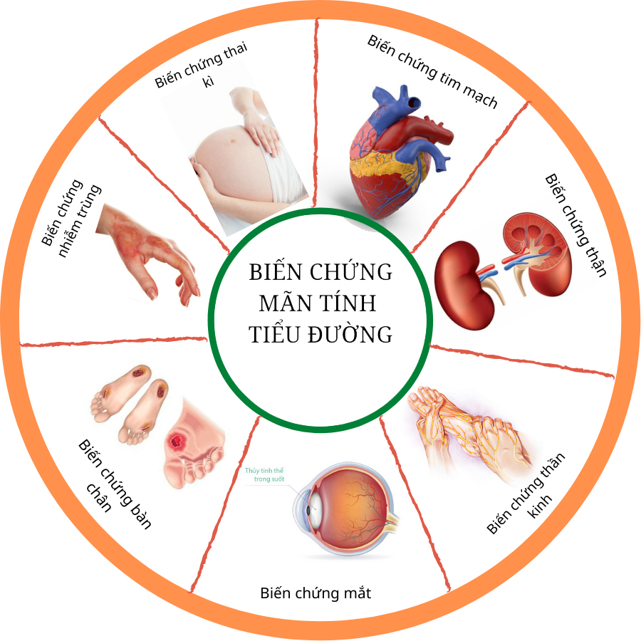 người bị tiểu đường dễ bị đột quỵ