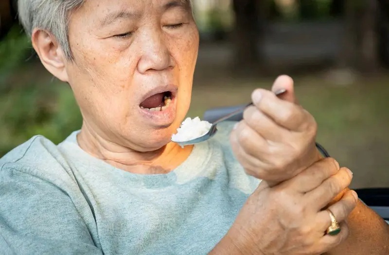 Dấu hiệu đột quỵ